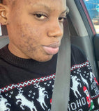 Turmeric sea moss Mask ***BEST SELLER
