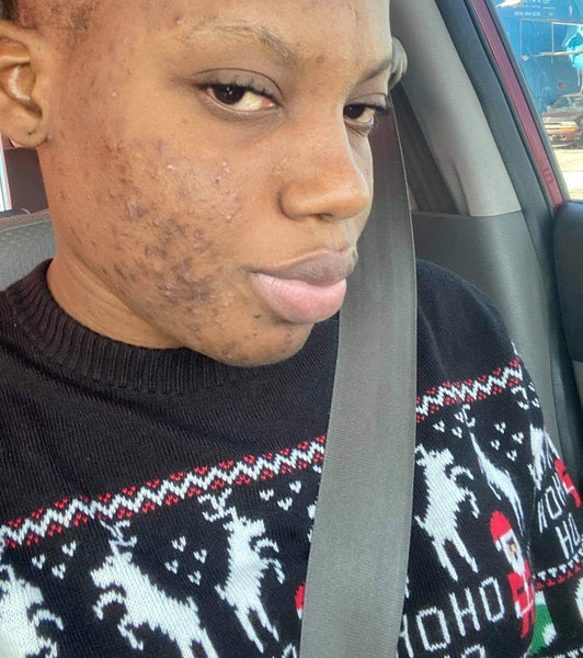 Turmeric sea moss Mask ***BEST SELLER